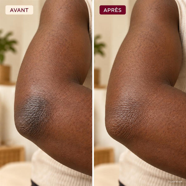 Avant / après 3