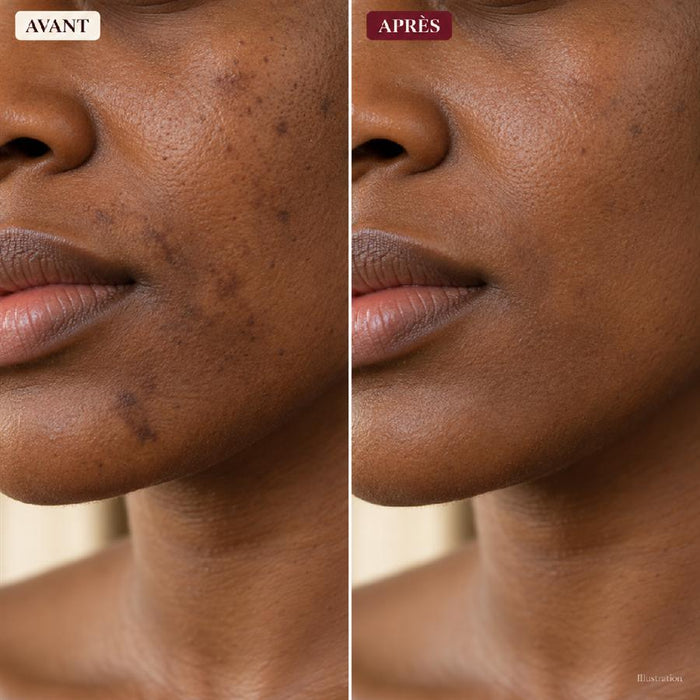 Visage avant / après 4