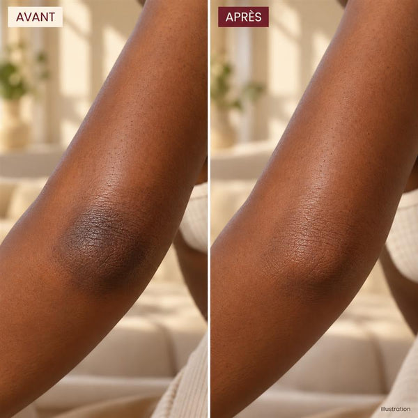 Avant / après 1