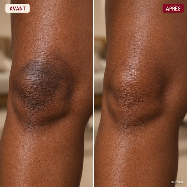 Avant / après 2