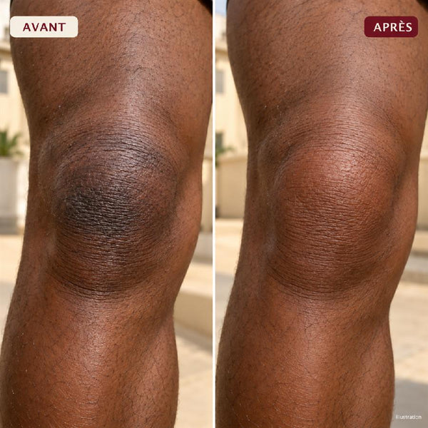 Avant / après 4
