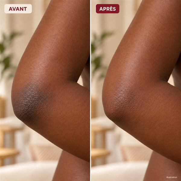Avant / après 5