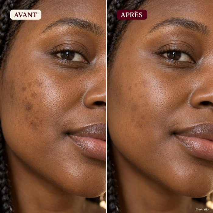 Visage avant / après 1