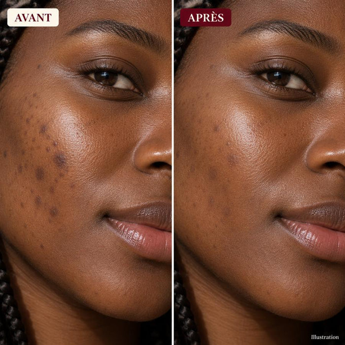Visage avant / après 2